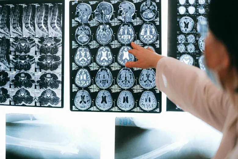 images/mri-point.webp
