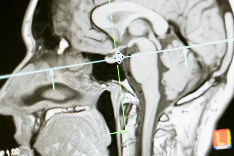 images/skull-scan.webp